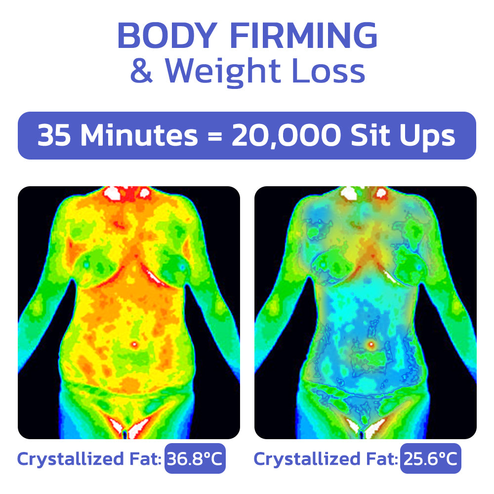 Ultherase™ LPGTech Cryolipolysis Cooler Spray