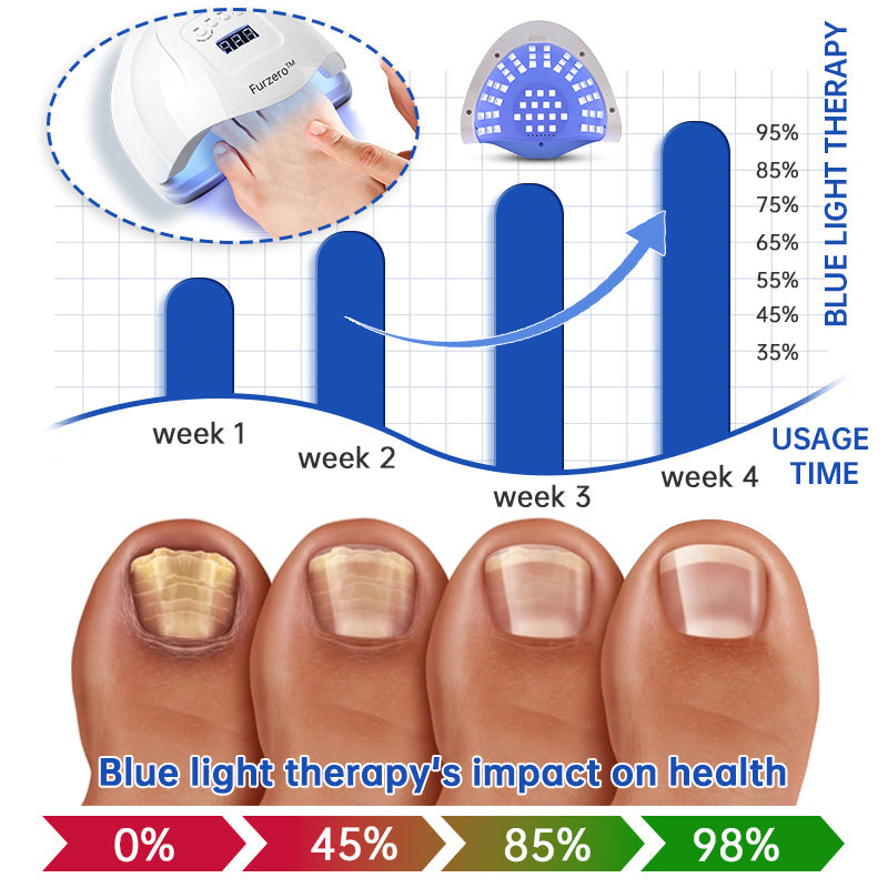 Furzero™ PureNail Fungus Laser Therapy Device