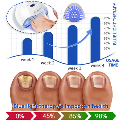 Furzero™ PureNail Fungus Laser Therapy Device