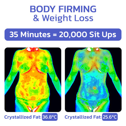 Ultherase™ LPGTech Cryolipolysis Cooler Spray