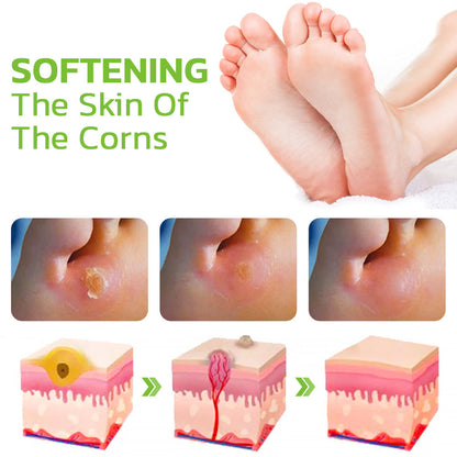 GFOUK™ IHerbal Foot Callus And Corns Removal Soak