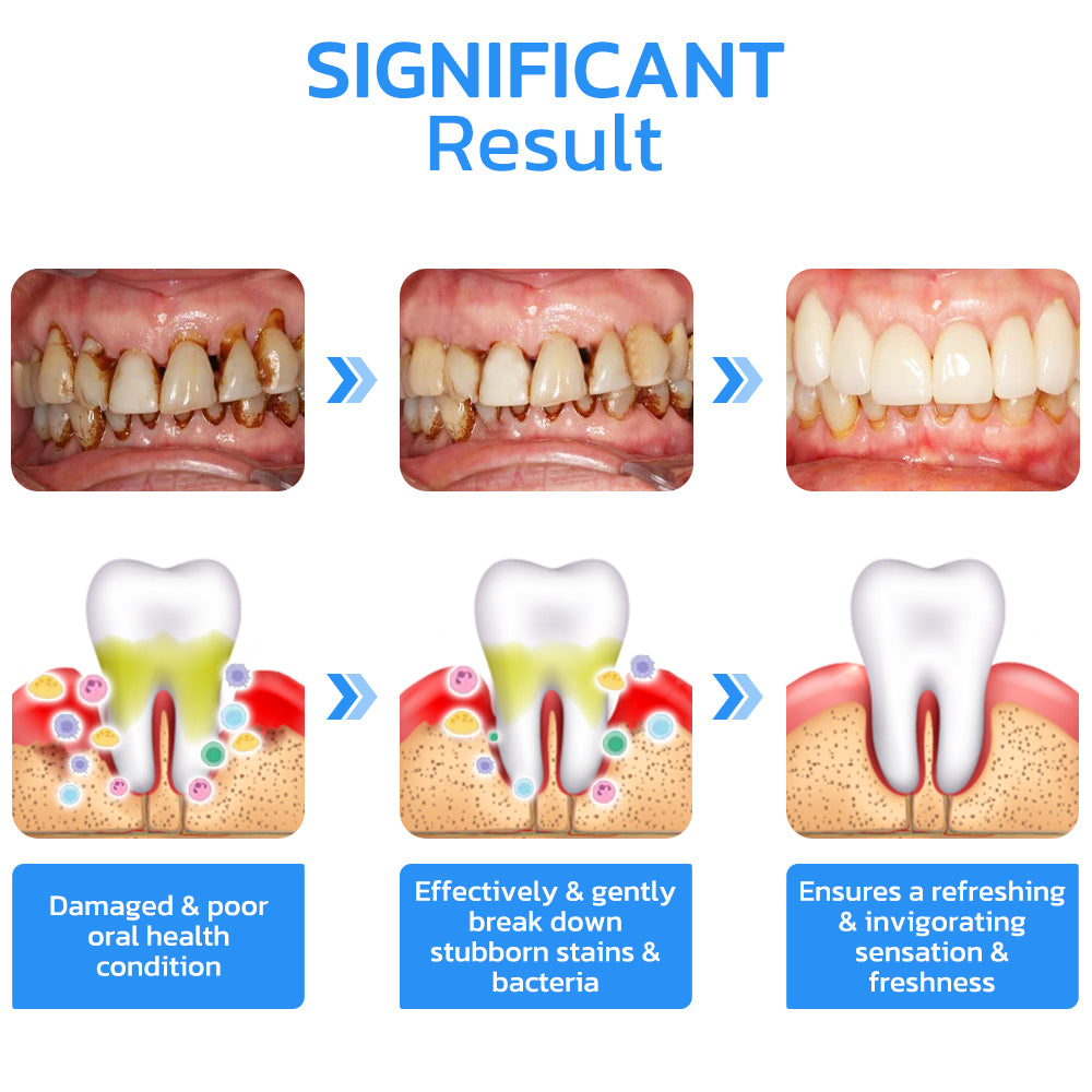 GFOUK™ Gum Instant Treatment Gel