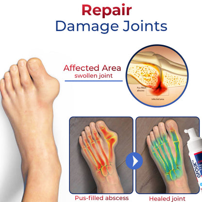 GFOUK™ JointMax Discomfort and Inflammation Relief Foam