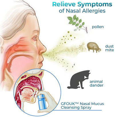 GFOUK™ Nasal Mucus Cleansing Spray